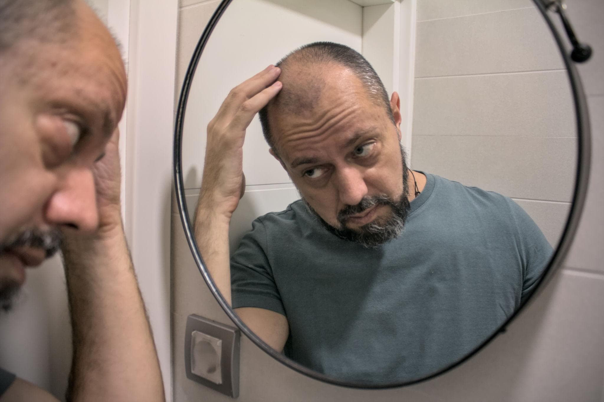 Homem percebendo falhas no cabelo no espelho